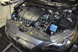 Injen 2017+ Toyota iA 1.5L Black Cold Air Intake - SP2025BLK